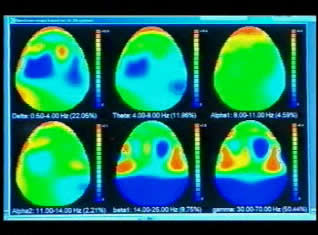 brain waves
